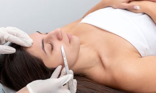 HOW MUCH DOES DERMAPLANING COST?