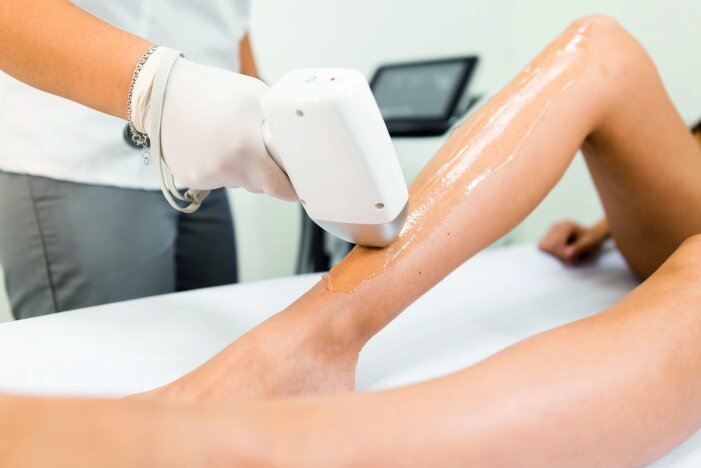 WHO SHOULD DO LASER HAIR REMOVAL?