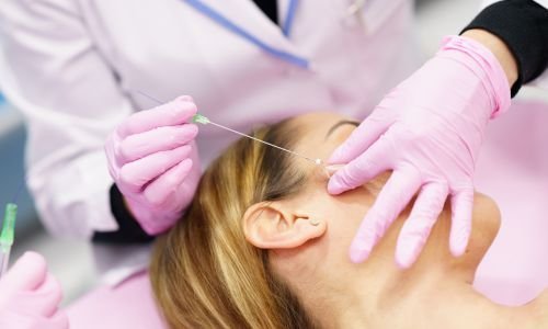 IS A VERTICAL PDO THREAD LIFT RIGHT FOR YOU?