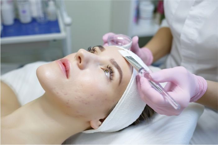 Different Types of Acne