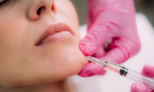 BEST TIPS FOR JAWLINE FILLER TREATMENT AFTERCARE