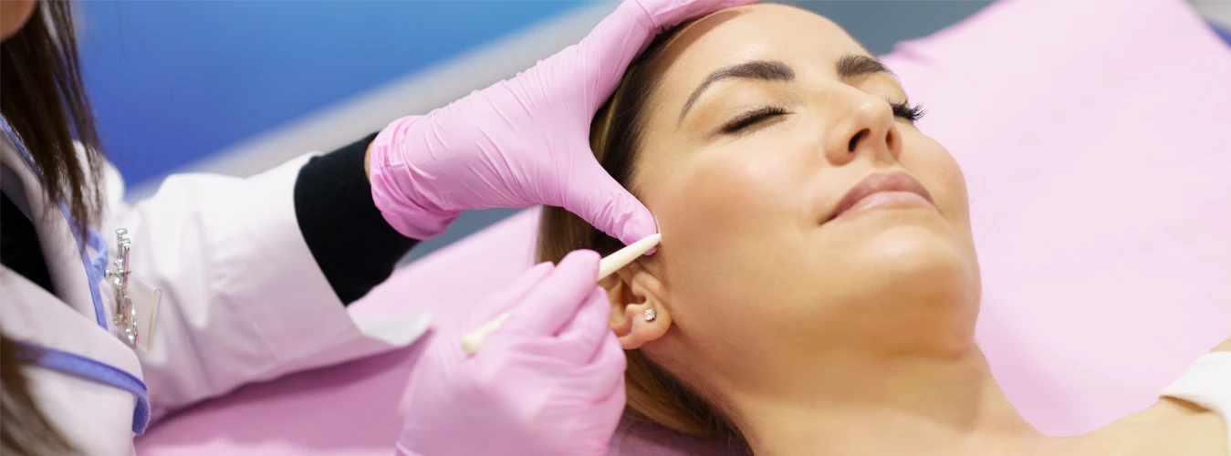 How Long Does a PDO Thread Lift Last?