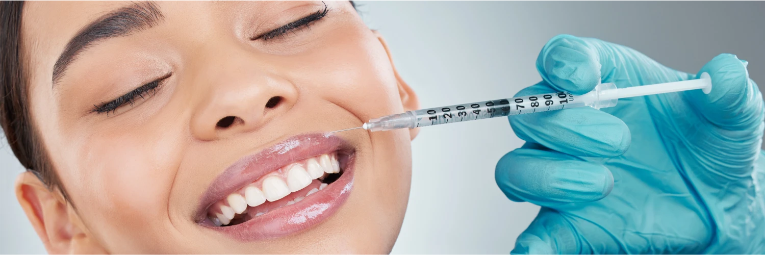 Botox for Smile Lines