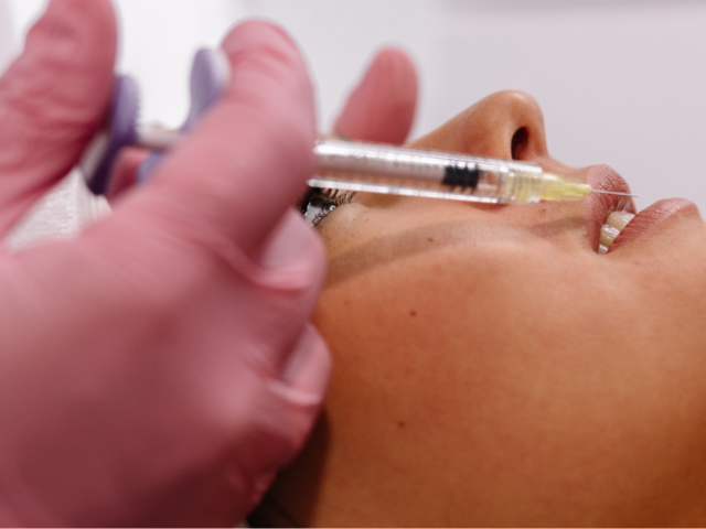 TIPS FOR MAINTAINING YOUR LIP FILLERS: DOS AND DON’TS