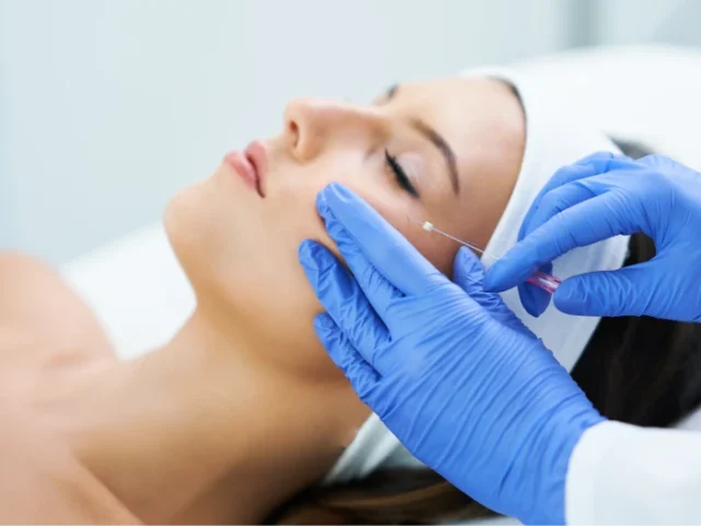 HOW DOES A PDO THREAD LIFT WORK TO REJUVENATE YOUR SKIN?