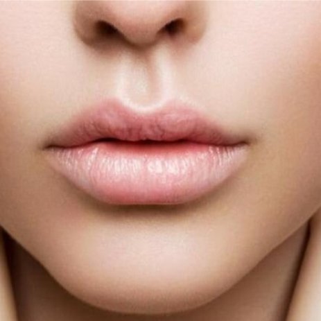 kybella huntingdon valley.jpg