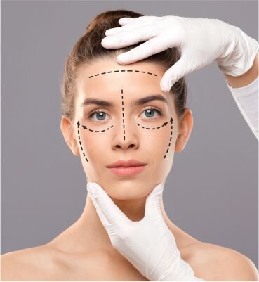 pdo thread lift before and after