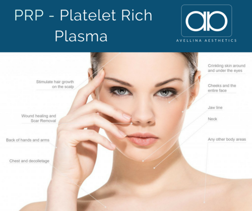 Platelet Rich Plasma Treatment Areas.png